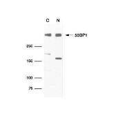 Anti-53BP1 antibody used in Western Blot (WB). GTX70316
