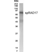 Anti-Rad17 antibody used in Western Blot (WB). GTX70346