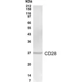 Anti-CD28 antibody used in Western Blot (WB). GTX70356