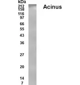 Anti-Acinus antibody used in Western Blot (WB). GTX70369