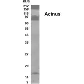 Anti-Acinus antibody used in Western Blot (WB). GTX70370