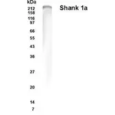 Anti-SHANK1a antibody used in Western Blot (WB). GTX70380