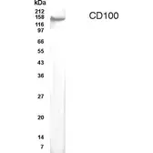Anti-CD100 antibody used in Western Blot (WB). GTX70396
