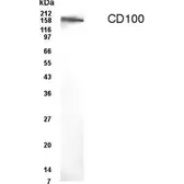 Anti-CD100 antibody used in Western Blot (WB). GTX70397