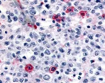 Anti-FANCJ antibody used in Immunohistochemistry (IHC). GTX70433