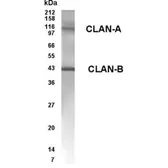 Anti-CARD12 antibody used in Western Blot (WB). GTX70445