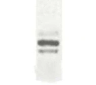 Anti-DCBLD2 antibody used in Western Blot (WB). GTX70450