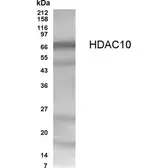 Anti-HDAC10 antibody used in Western Blot (WB). GTX70464