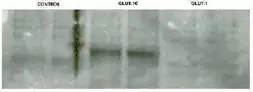Anti-GLUT10 antibody used in Western Blot (WB). GTX70487