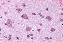 Anti-5-HT2B receptor antibody used in IHC (Paraffin sections) (IHC-P). GTX70497