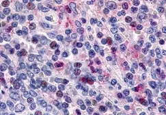 Anti-CCR1 antibody used in IHC (Paraffin sections) (IHC-P). GTX70509