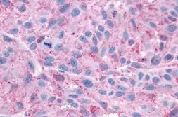 Anti-CXCR3 antibody used in IHC (Paraffin sections) (IHC-P). GTX70527