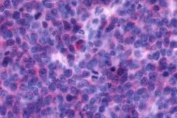 Anti-CXCR4 antibody used in IHC (Paraffin sections) (IHC-P). GTX70531