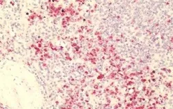 Anti-GPR84 antibody used in IHC (Paraffin sections) (IHC-P). GTX70841