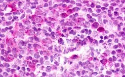 Anti-EBI2 antibody used in IHC (Paraffin sections) (IHC-P). GTX70863