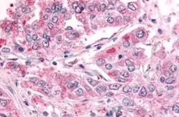 Anti-SGK2 antibody used in IHC (Paraffin sections) (IHC-P). GTX70977