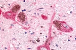 Anti-MAP4K6 antibody used in IHC (Paraffin sections) (IHC-P). GTX70987