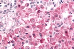 Anti-DUSP22 antibody used in IHC (Paraffin sections) (IHC-P). GTX70991