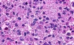 Anti-LGR5 antibody used in IHC (Paraffin sections) (IHC-P). GTX71143