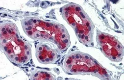 Anti-TSH receptor antibody used in IHC (Paraffin sections) (IHC-P). GTX71175