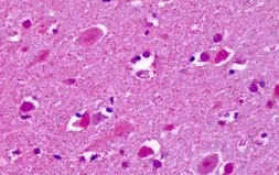 Anti-CELSR2 antibody used in IHC (Paraffin sections) (IHC-P). GTX71269