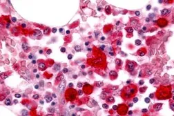 Anti-RON antibody used in IHC (Paraffin sections) (IHC-P). GTX71655