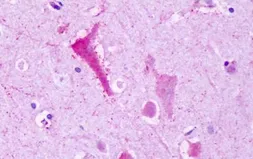 Anti-TM7SF1/GPR137B antibody used in IHC (Paraffin sections) (IHC-P). GTX71669