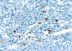 Anti-Mast cell chymase antibody [CC1] used in IHC (Paraffin sections) (IHC-P). GTX72388