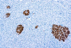 Anti-NSE antibody (ready-to-use) used in IHC (Paraffin sections) (IHC-P). GTX72911