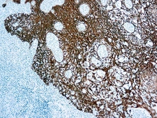 Anti-pan Cytokeratin antibody [MNF116] (ready-to-use) used in IHC (Paraffin sections) (IHC-P). GTX73399