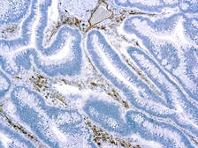 Anti-CD31 antibody [JC/70A] (ready-to-use) used in IHC (Paraffin sections) (IHC-P). GTX73514