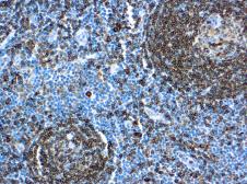Anti-CD74 antibody [LN2] (ready-to-use) used in IHC (Paraffin sections) (IHC-P). GTX73535