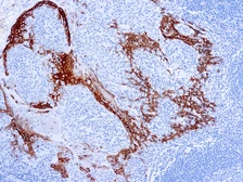 Anti-Cytokeratin 16 antibody [LL025] used in IHC (Paraffin sections) (IHC-P). GTX73557