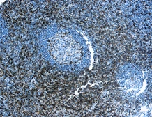 Anti-CD43 antibody [DF-T1] used in IHC (Paraffin sections) (IHC-P). GTX73633