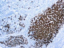 Anti-Hepatocyte Specific Antigen antibody [OCH1E5] used in IHC (Paraffin sections) (IHC-P). GTX73779