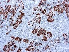 Anti-ACTH antibody [AH26] used in IHC (Paraffin sections) (IHC-P). GTX73794