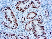 Anti-MSH6 antibody [44] used in IHC (Paraffin sections) (IHC-P). GTX73803