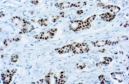 Anti-Estrogen Receptor alpha antibody [6F11] (ready-to-use) used in IHC (Paraffin sections) (IHC-P). GTX73808