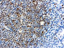 Anti-Cyclin D1 antibody [DCS-6] used in IHC (Paraffin sections) (IHC-P). GTX73878