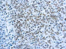 Anti-CDC25A antibody [DCS-120 + DCS-121] used in IHC (Paraffin sections) (IHC-P). GTX73947