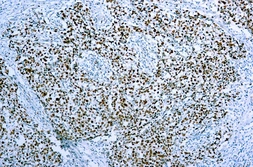 Anti-MCM7 antibody [47DC141] used in IHC (Paraffin sections) (IHC-P). GTX73948