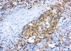 Anti-VEGF Receptor 2 antibody used in IHC (Paraffin sections) (IHC-P). GTX73967