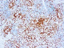Anti-ALK antibody [5A4] used in IHC (Paraffin sections) (IHC-P). GTX73978