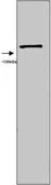 Anti-iNOS antibody used in Western Blot (WB). GTX74171
