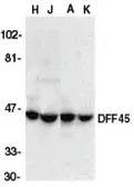 Anti-ICAD antibody used in Western Blot (WB). GTX74223