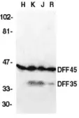 Anti-ICAD antibody used in Western Blot (WB). GTX74224