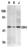 Anti-DR4 antibody used in Western Blot (WB). GTX74228