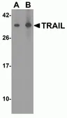 Anti-TRAIL antibody used in Western Blot (WB). GTX74230