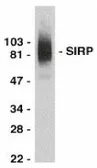 Anti-SIRP alpha antibody used in Western Blot (WB). GTX74233