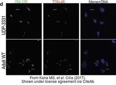 Anti-TGN46 antibody used in Immunocytochemistry/ Immunofluorescence (ICC/IF). GTX74290